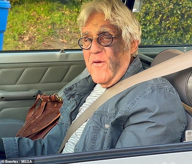 Jay Leno has sparked a wild conspiracy theory after suffering a 60-foot fall down a hill that left him with significant bruising to the left side of his face, an eyepatch and a broken wrist (seen on Wednesday)